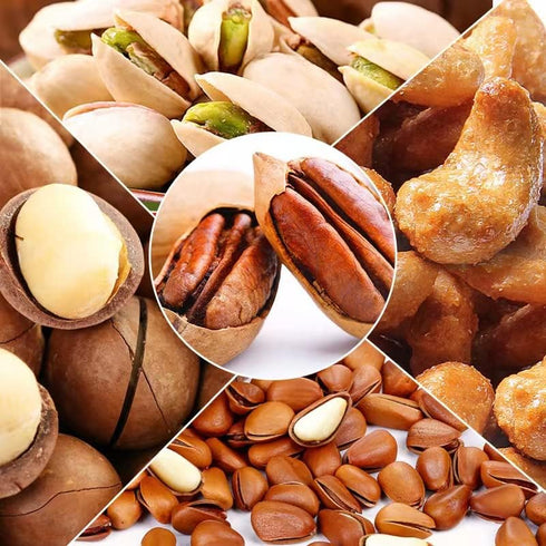 MxTong Nut Cracker Heavy Duty Nutcracker Macadamia Cracker Stainless Steel Nut Cracker Tool for Walnut Hazelnut Almonds