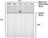 River Dream Plastic Snap in Shower Curtain Liner Replacement with Magnets, Removable Liner (1, Plastic-Update)