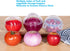 Ortarco Onion Keeper - Reusable Onion Storage Containers