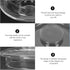 Cabilock 2pcs Replacement Glass Lid for Tea Kettle, Transparent Beverage Dispenser Lid, Household Tea Cup Covers