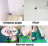 Bathroom Brushes Kitchen Cleaning Brush Set, Toilet Bowl Brush, Stiff Bristles, Durable 13.5-Inch Deep Cleaning