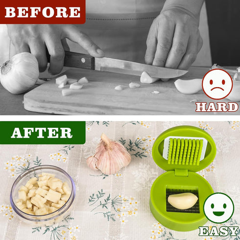 Deftomo Garlic Press Stainless Steel, Garlic Mincer Tool with Storage Container, Garlic Chopper with Peeler Skin